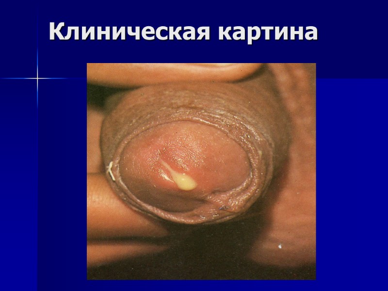 Клиническая картина